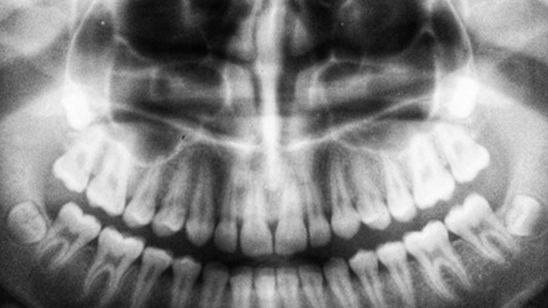 5 Key Benefits Offered by a Dental Check-up
